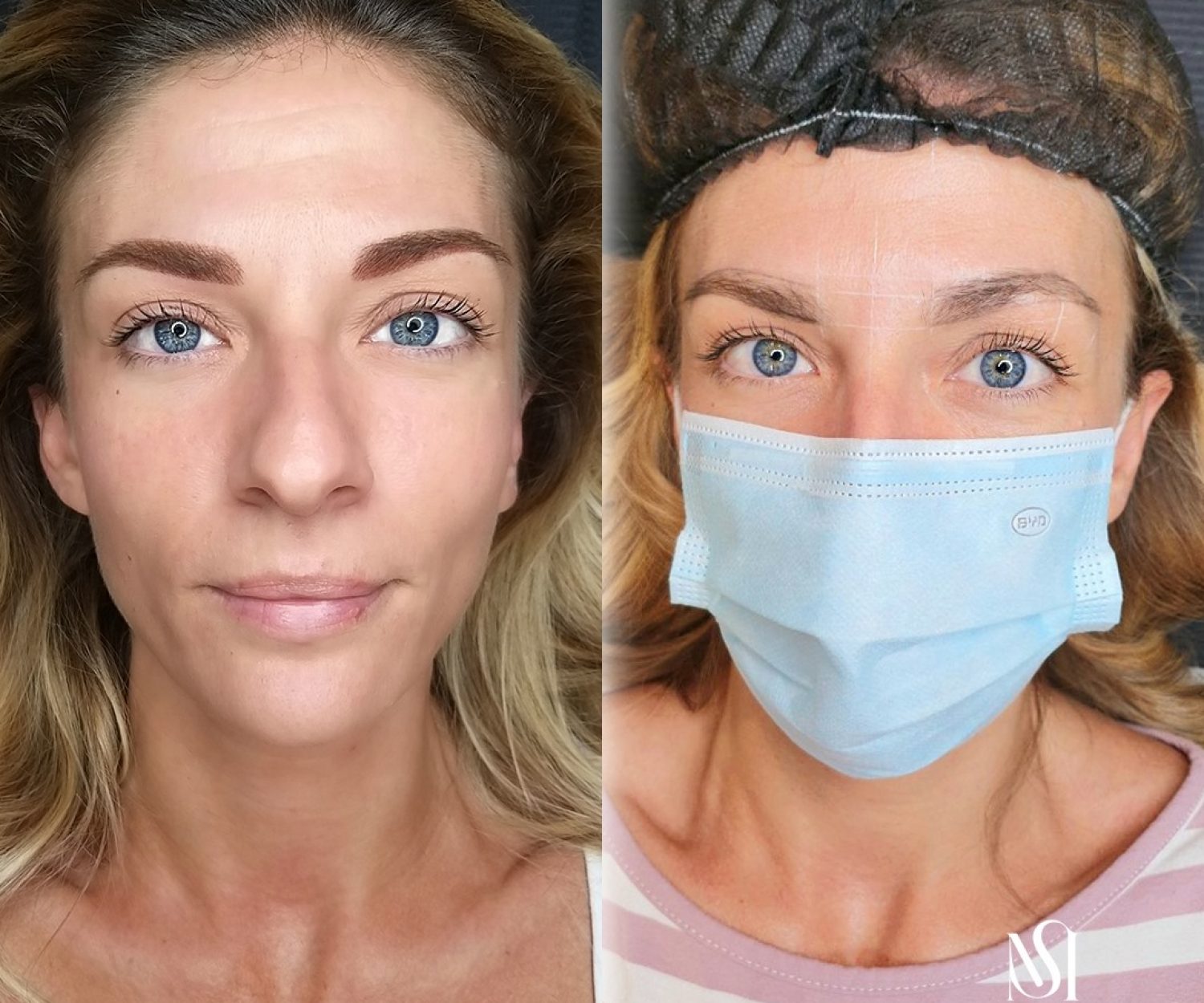 Trucco permanente sopracciglia, le foto del prima e del dopo