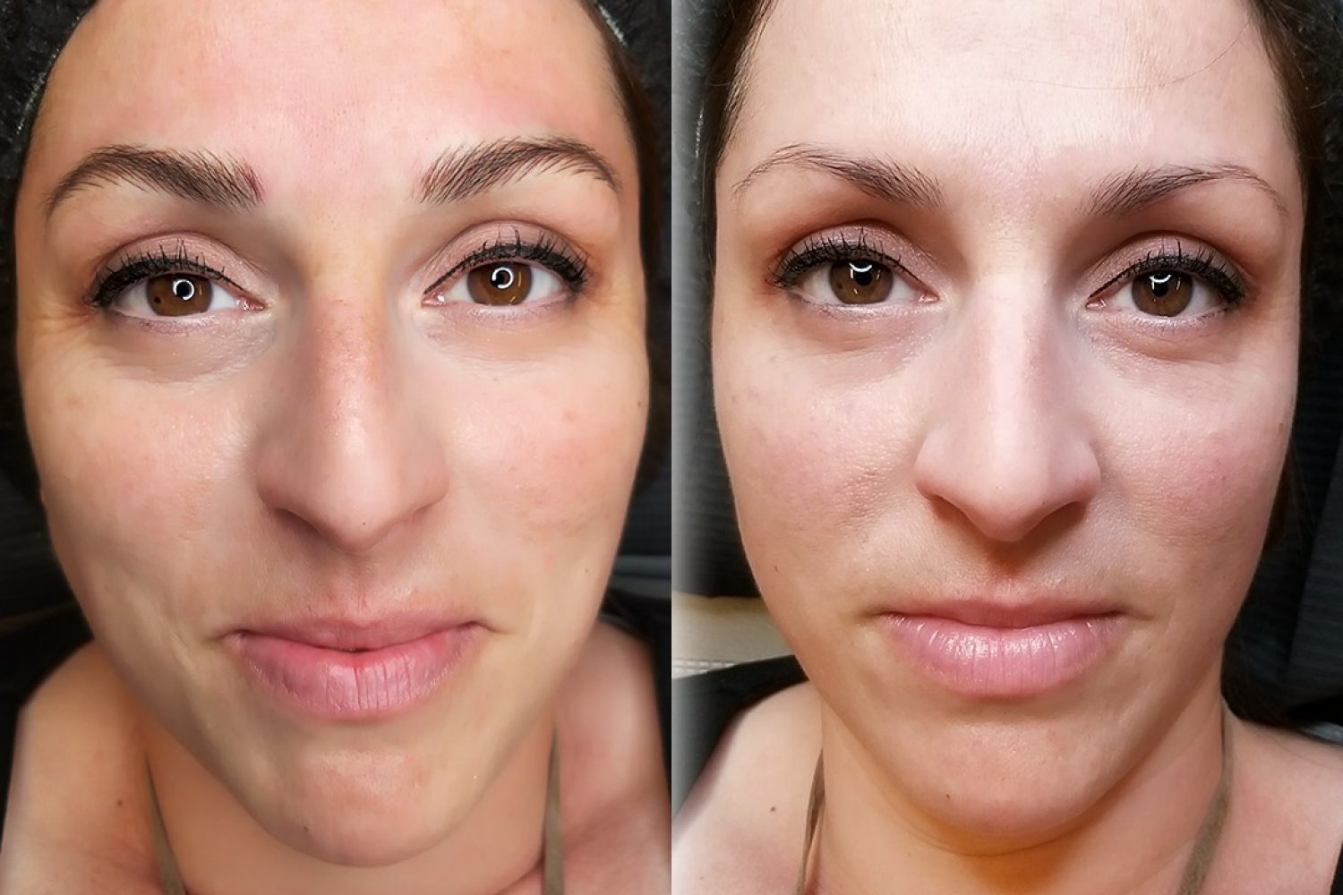 infoltimento e definizione sopracciglia con il trucco permanente