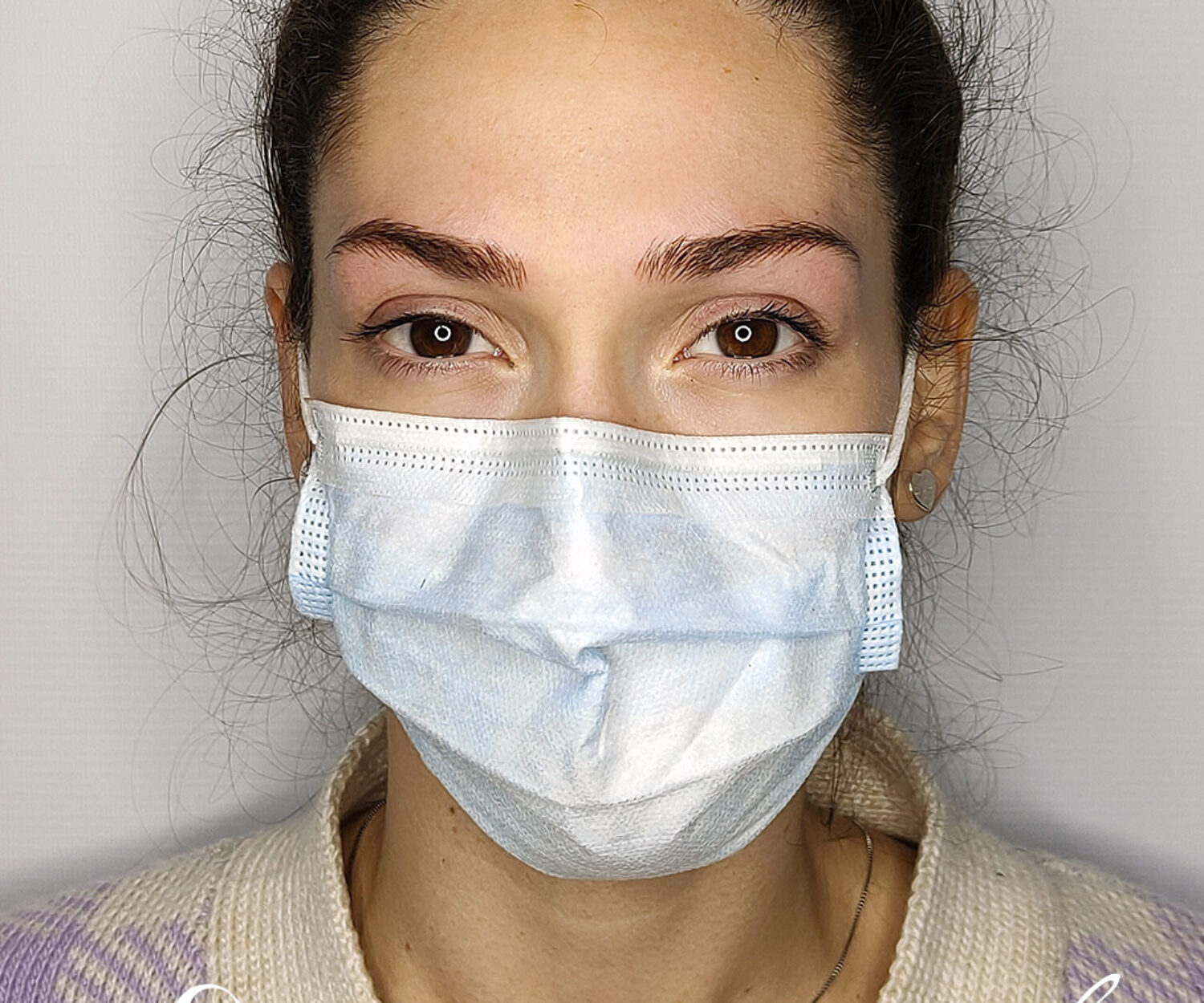 Come ho infoltito il sopracciglio con la dermopigmentazione