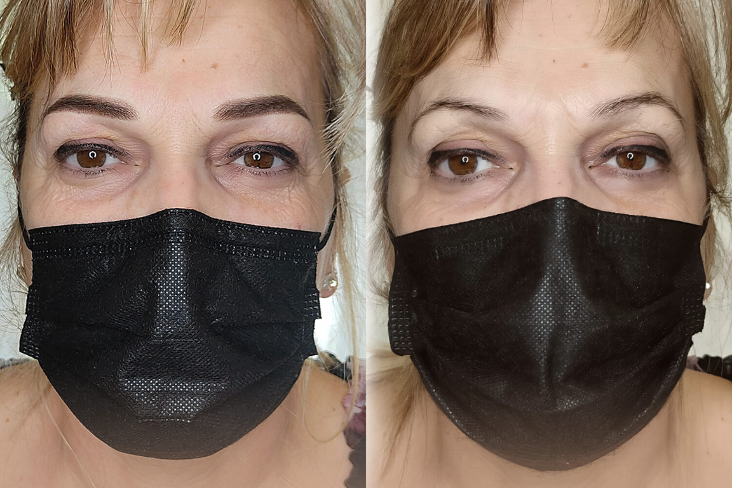 Trucco semipermanene Sopracciglia: valorizzare lo sguardo e ringiovanirlo con al dermopigmentazione