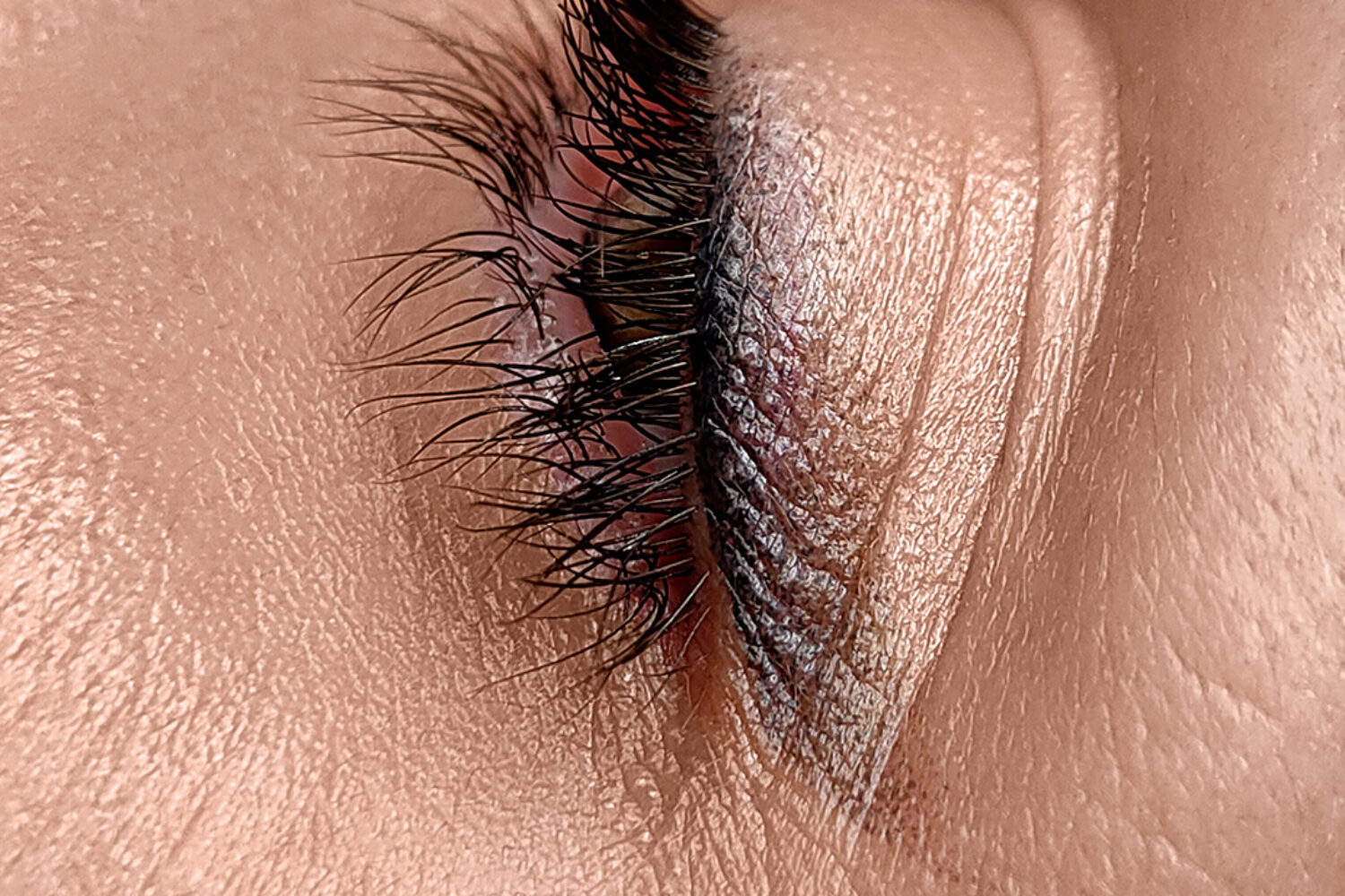 Trucco permanente a cosa serve la seconda seduta di dermopigmentazione