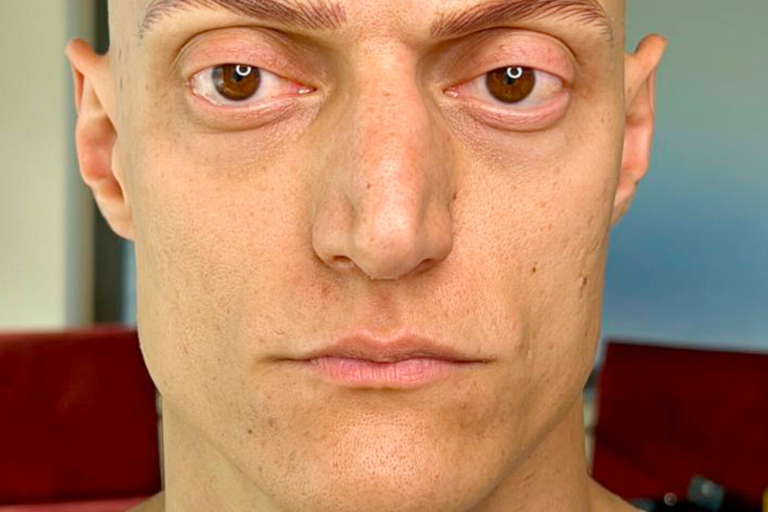 Sopracciglia maschili tatuate: come ho risolto l'alopecia totale di questo cliente uomo