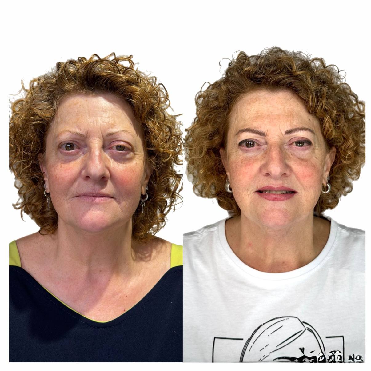 Trucco permanente in età adulta: prima e dopo