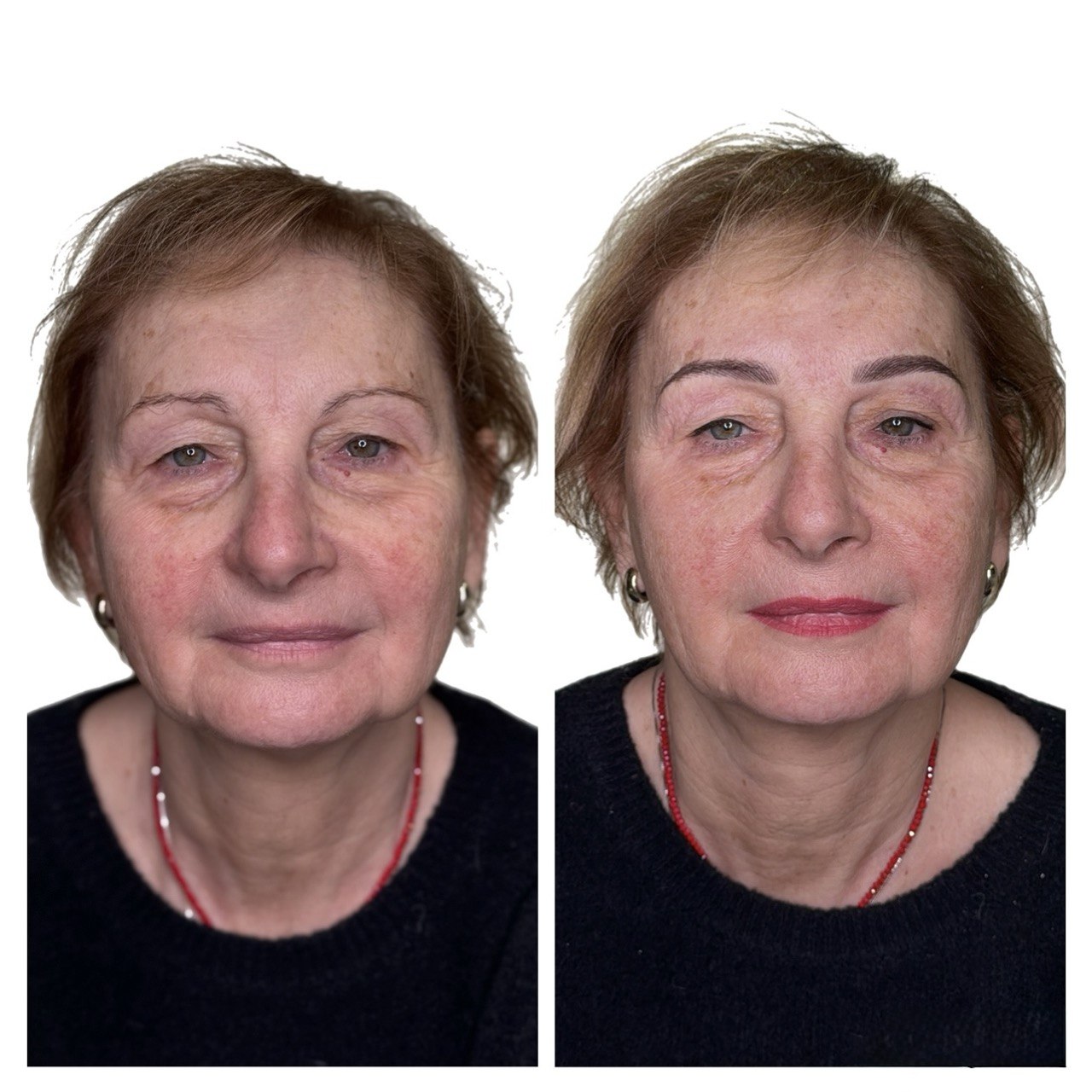 Trucco permanente in età matura: prima e dopo (1)