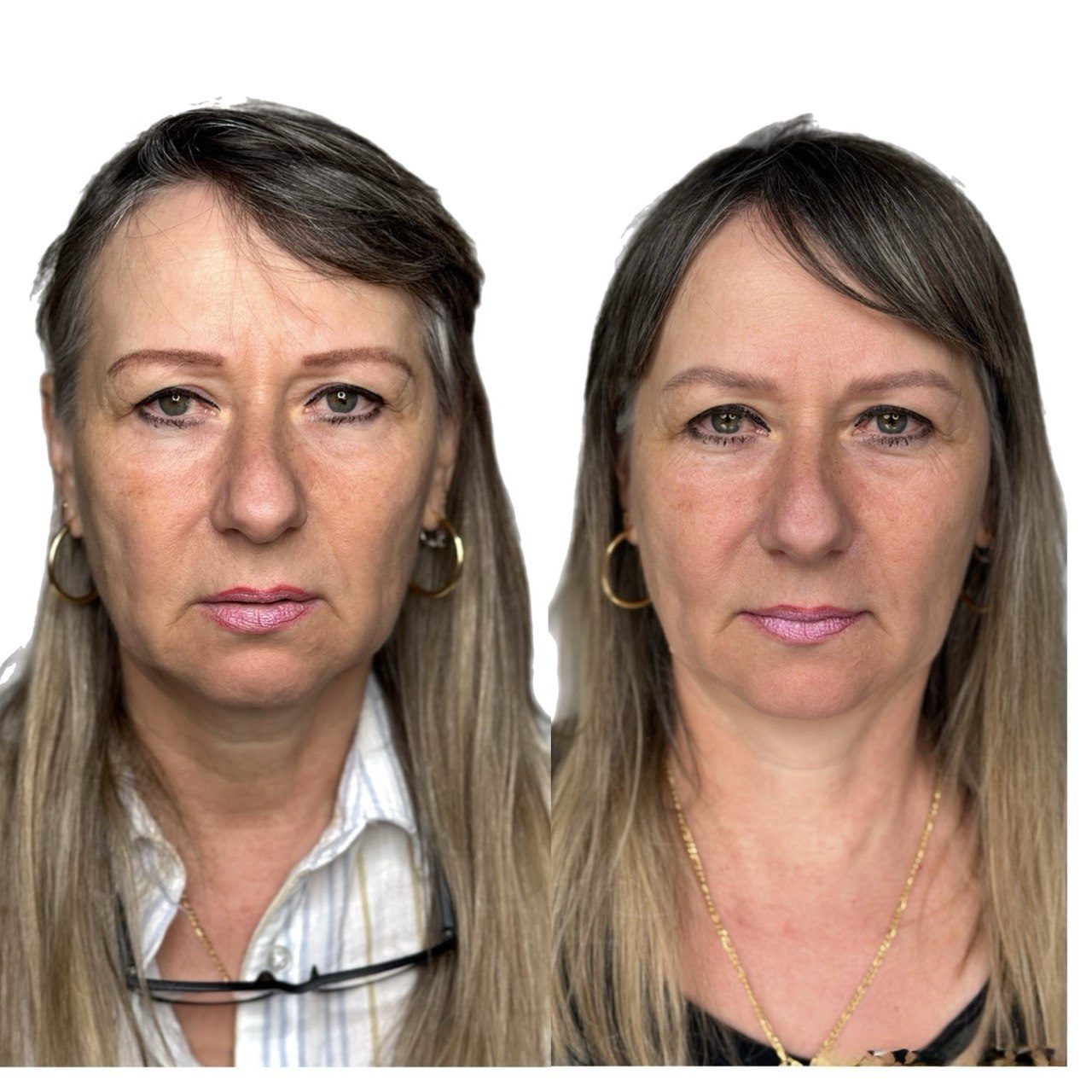 Trucco permanente in età matura: prima e dopo (2)