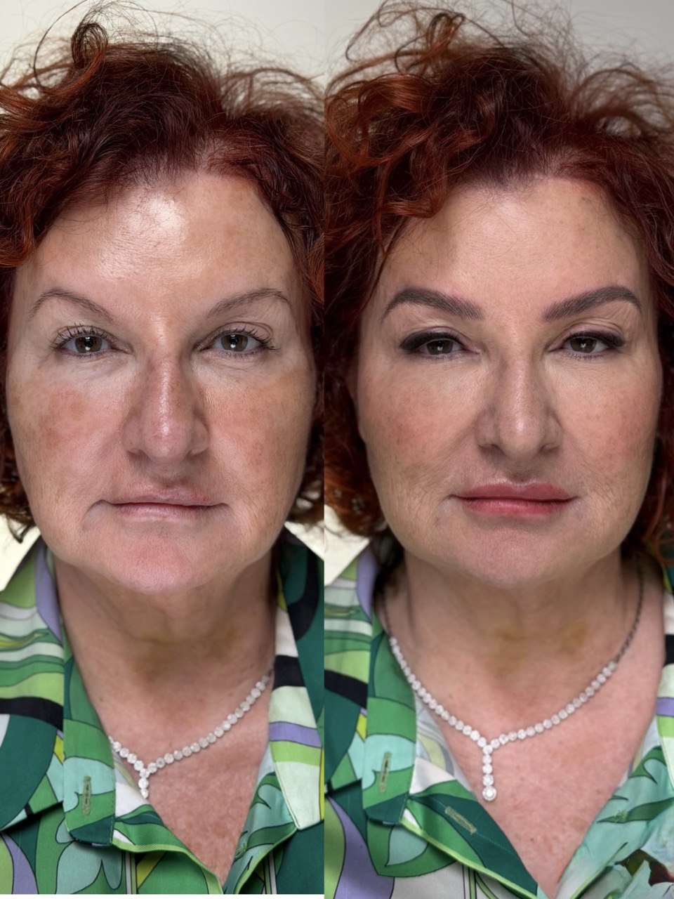 Trucco permanente in età matura: prima e dopo (3)